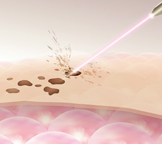 치료방법 이미지